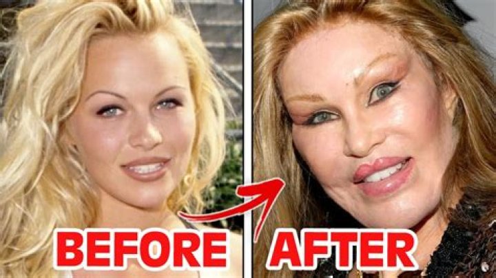 Before And After Plastic Surgery Revelations